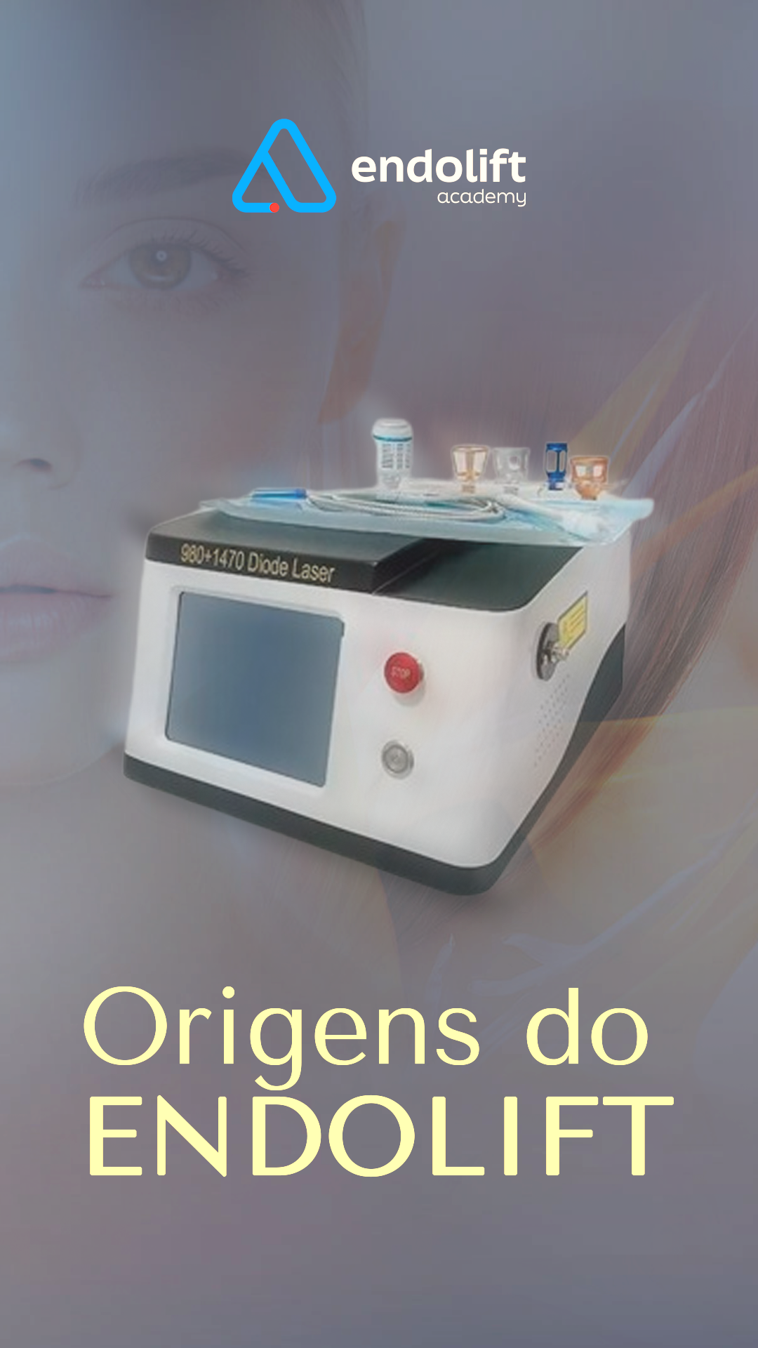 Endolift